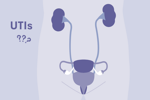 What you should know about UTIs