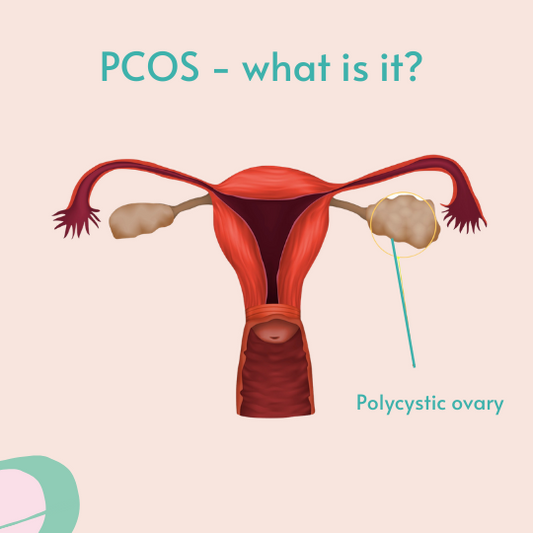 PCOS. What’s the lowdown?